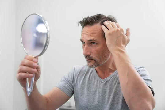 Hair Loss Problems
